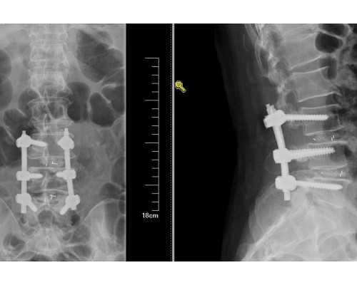 广州可靠代孕妈妈及知名三代试管医院推荐