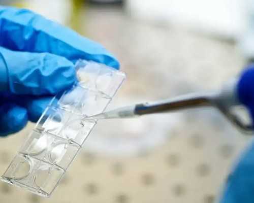 广州供卵包成功,广州有供卵的医院是哪一家_放生田螺消业障很快